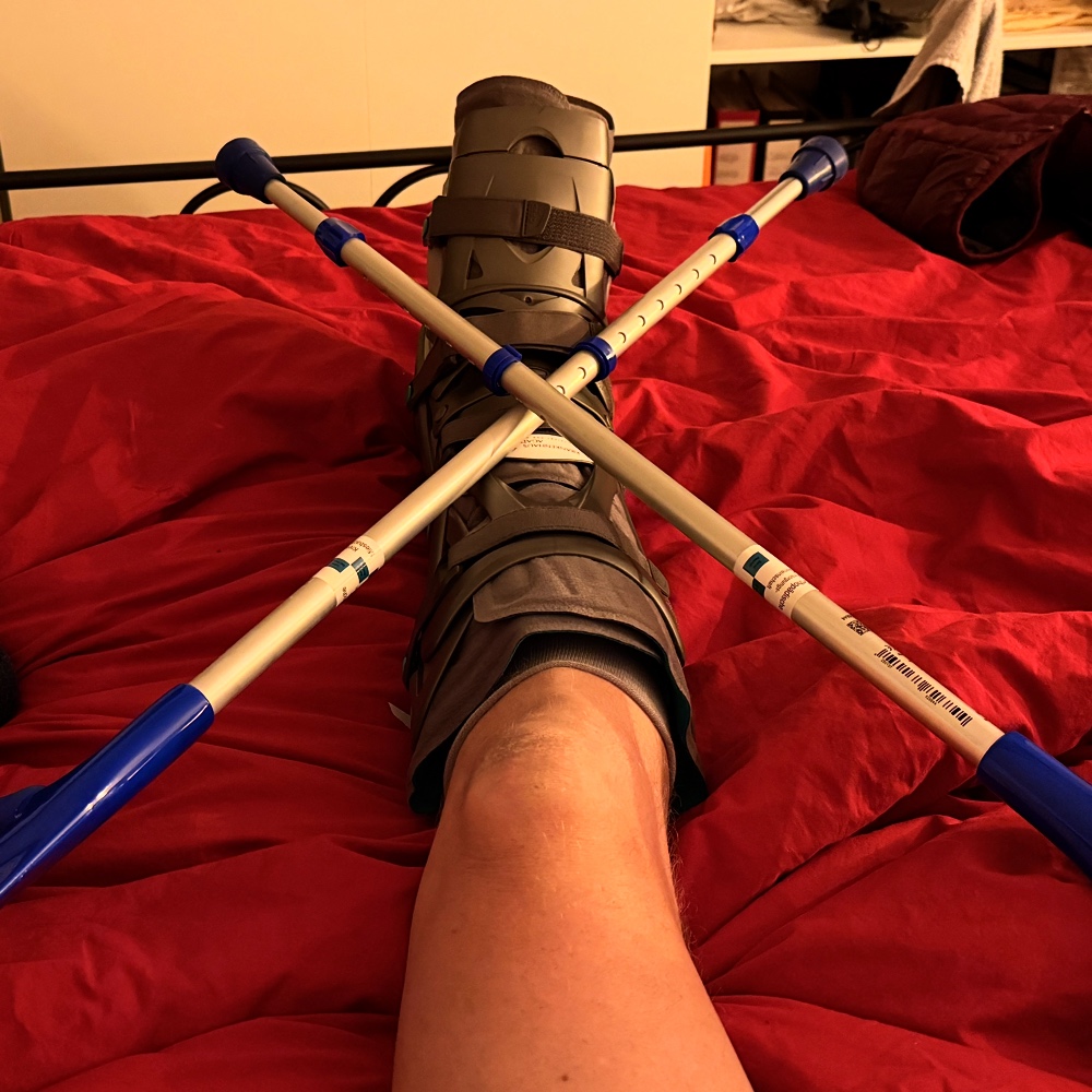 d1 / Impact of the&nbsp;injury