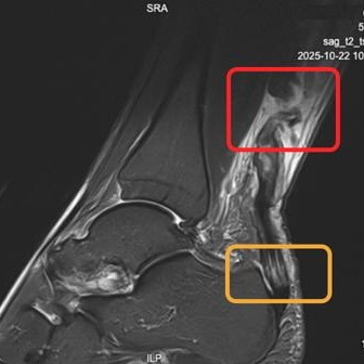 d3 / MRI and clinic&nbsp;visit
